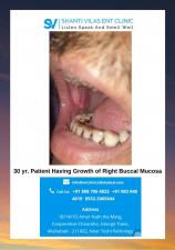 30 yr. Patient Having Growth of Right Buccal Mucosa - Dr. AK Shukla Shanti Vilas ENT Clinic Prayagraj